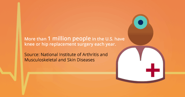 More than 1 million people in the US have knee or hip replacement surgery each year. Source: National Institute of Arthritis and Musculoskeletal and Skin Diseases