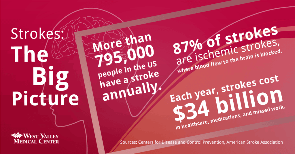 Strokes: the Big Picture. More than 795,000 people in the US have a stroke annually. 87% of strokes are ischemic strokes, where blood flow to the brain is blocked. Each year, strokes cost $34 billion in healthcare, medications, and missed work,